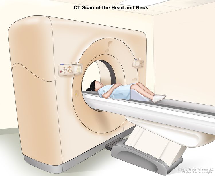 Computed tomography (CT) scan of the head and neck; drawing shows a child lying on a table that slides through the CT scanner, which takes a series of detailed x-ray pictures of the inside of the head and neck. Computed tomography (CT) scan of the head and neck; drawing shows a child lying on a table that slides through the CT scanner, which takes a series of detailed x-ray pictures of the inside of the head and neck.